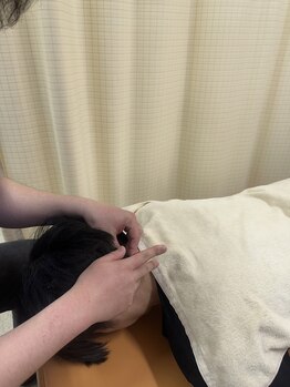むげん整骨院鍼灸院 桃山大手筋/頑固なコリには鍼灸施術◎