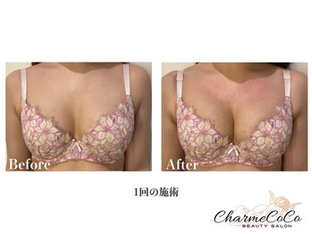 シャルムココ 蔵前店(CharmeCoCo)/お客様Before→After