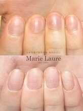 マリーロール 淀屋橋本店(Marie Laure)/自爪育成/深爪矯正/ネイルケア