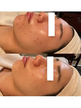 アンジェラックス 福岡天神店/