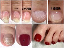 ネイルサロン ルレーヴ(Nail Salon le reve)の雰囲気（【深爪ケア、自爪育成】足の爪も長さ出しできます☆）