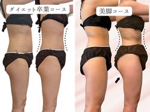 ヨサパーク アーバンヘブン 目黒(YOSA PARK Urban Heaven)/短期期間で集中ダイエット！