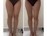 人気No.1【脂肪冷却】２カップ＋キャビテーション＋脂肪分解液導入