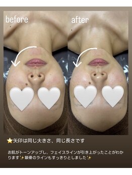 ウォームメモリー(warmmemory)/フェイシャルエステ