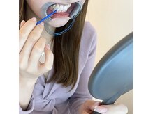 エクシアホワイトニング 中野駅北口店/施術の流れ5