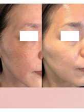 リンクアンドボーテ 大垣(Link&Beaute)/肌改善.エイジングケア