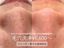 アトリア(ATRIA)の雰囲気（【毛穴洗浄】毛穴詰まり・開き・黒ずみ徹底ケア｜なめらか素肌へ）