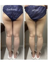 エンチャント(ENCHANT)/お尻、太ももは永遠のテーマ