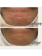 インチャント(enchant)/硬く乾燥した肌のシワケア