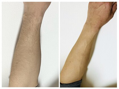 ハイドア(high door)の写真