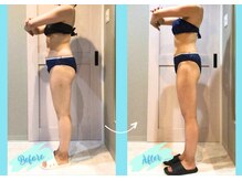 千歳の女神 西尾本店/【施術風景】Before/After