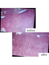 アップルミント/