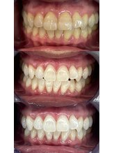 サロンニウ(salon_niu.)/7回目の症例（40代女性）