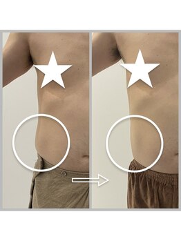 エステサロンパリス(Esthe Salon Paris)/お酒大好きな50代後半の男性　