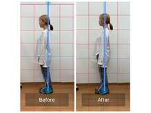 写真でビフォーアフターを視覚的にも実感！