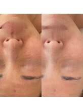 シルク(Silk)/ポテンツァ(エステ版)