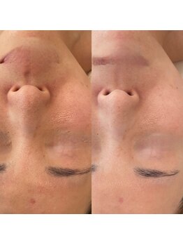 シルク(Silk)/ポテンツァ(エステ版)