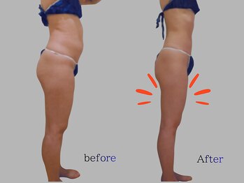 プレリー 自由が丘店/強力バキューム吸引でセル撃破！