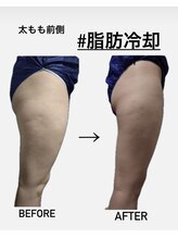 シャルム(CHARME)/寝ながらダイエット