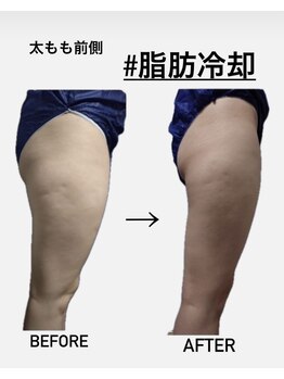 シャルム(CHARME)/寝ながらダイエット