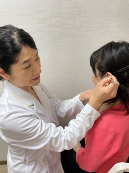 ミラクル ビー(ミラクル Bee)/施術写真