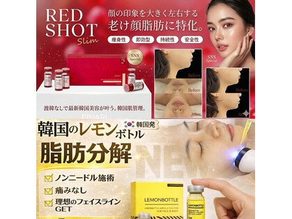 ピナリ(PINARI)の写真