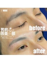男前倶楽部/脱毛/メンズ脱毛/メンズ専門店