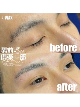 男前倶楽部/脱毛/メンズ脱毛/メンズ専門店