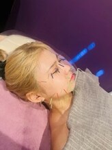 アディクト(Addict)/フェイスラインキュッと