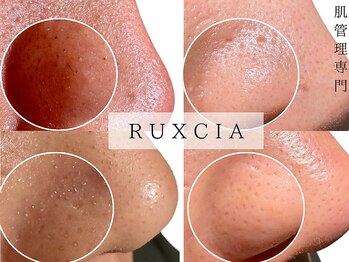 ルクシア(RUXCIA)/ビフォーアフター