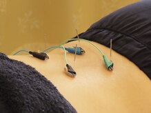 小笠原鍼灸接骨院/鍼灸［所沢/下山口］