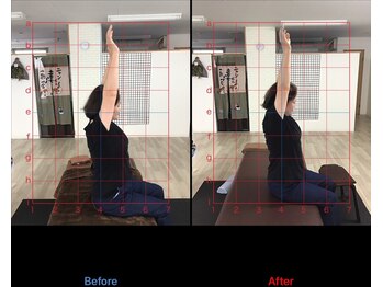 ストレチックス 近江八幡店/BeforeAfter