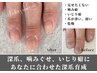 あなたの爪を一緒に育てる【パーソナル深爪育成】¥11,550→¥8,800