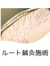 ≪本気で改善したい人≫ルート鍼灸　ハリネズミ鍼
