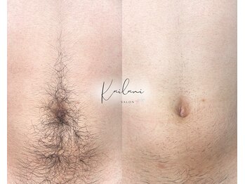 カイラニ サロン(Kai lanl salon)/男性　へそ回り