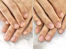 リファーレ(RIFARE)/【深爪矯正】見せたくなるお爪に