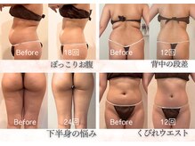 ハナ チュチュ(Hana chuchu)の雰囲気（セルゼロなら美しくサイズダウンが叶う★メリハリボディライン◎）