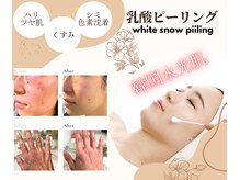 アフロディーテ(Aphrodite)/◆乳酸ピーリング◆