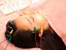 【美容鍼】鍼が始めての方オススメ。電気あり 50分￥7,000