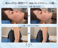 リフト 栄(Lift)