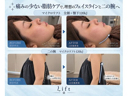 リフト 栄(Lift)の写真