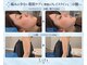 リフト 栄(Lift)の写真