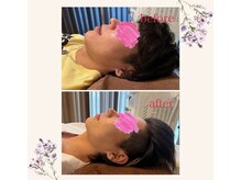 ウナ デ リンゴル 恵比寿店(UNA de Ringol)/当店1番人気小顔メニュー¥13500