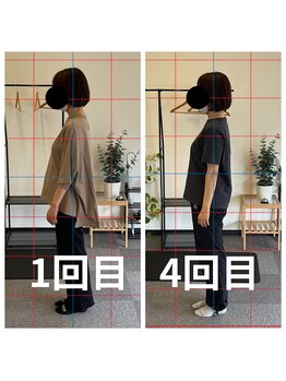 熊本カワル整体 JR上熊本駅院/4回目のお客様