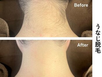 ギルドハナレ(GUILD HANARE)/"自信が持てる後ろ姿に"