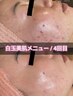 【OPEN記念★口コミ記載】白玉美肌メニュー☆¥13000→¥4400