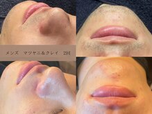 ヴィーヴォ(Vivo)/メンズ　マツヤニ＆クレイ