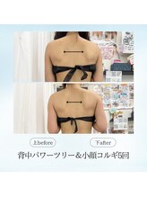 エスプレッソ(espresso,)/【巻き肩】直してキャシャ見え