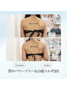 エスプレッソ(espresso,)/【巻き肩】直してキャシャ見え