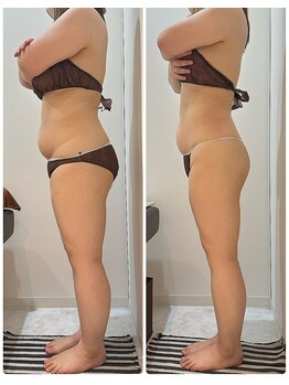 グッドライフエステ/Before＆Afteｒ　キャビ